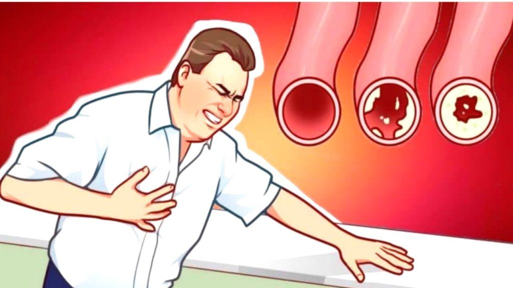 foods that help clean your arteries